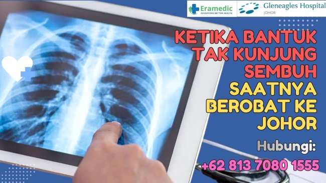 Ketika Bantuk tak Kunjung Sembuh Saatnya Berobat ke Johor